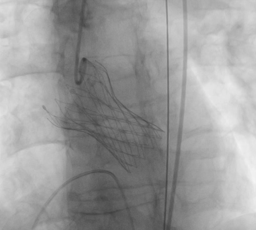 16886988025316.png 16886988025316.png