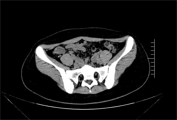 17026110978084.png 17026110978084.png