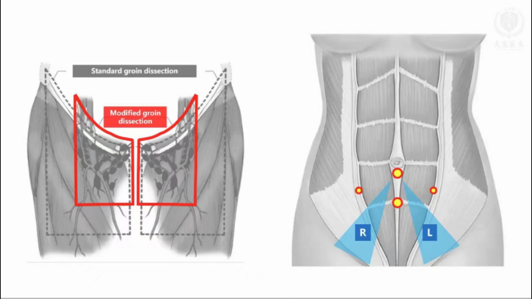 17140961159404.png 17140961159404.png