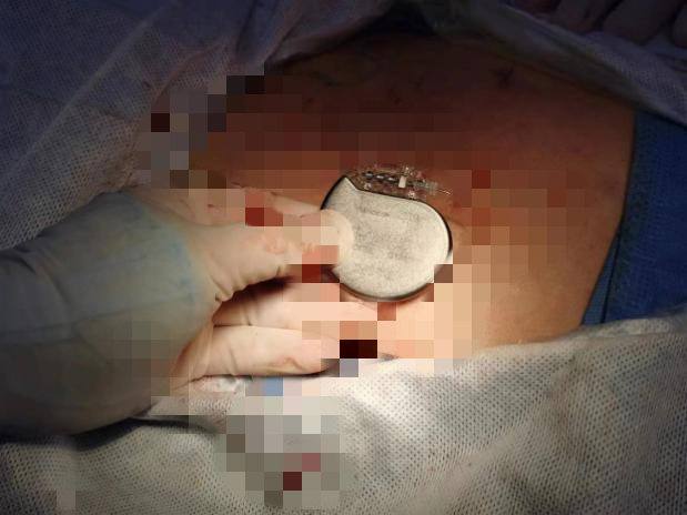 17161704842885.png 17161704842885.png