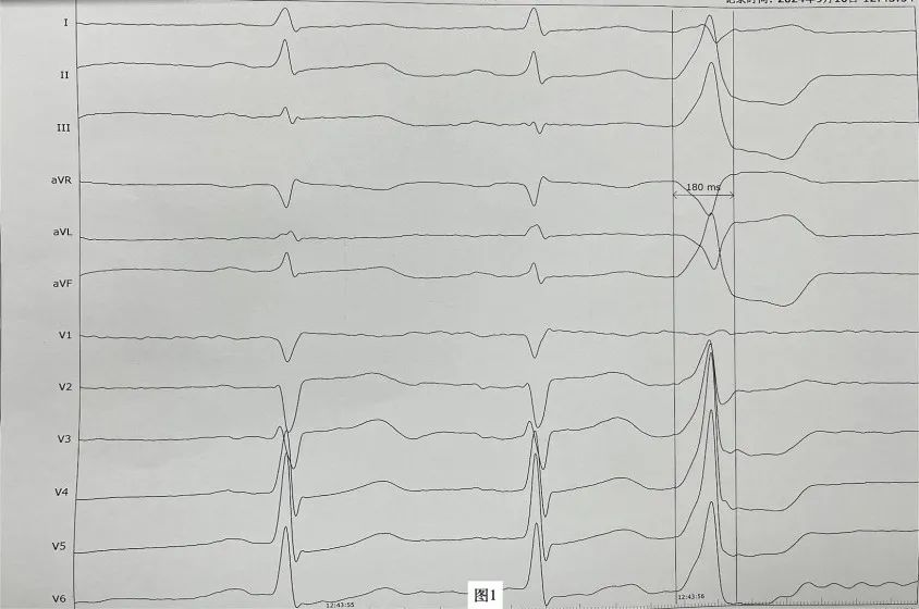 17275716025196.jpg 17275716025196.jpg