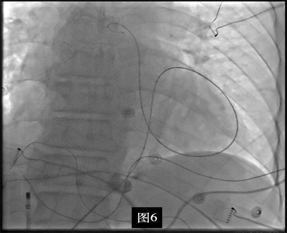 17275717007286.png 17275717007286.png