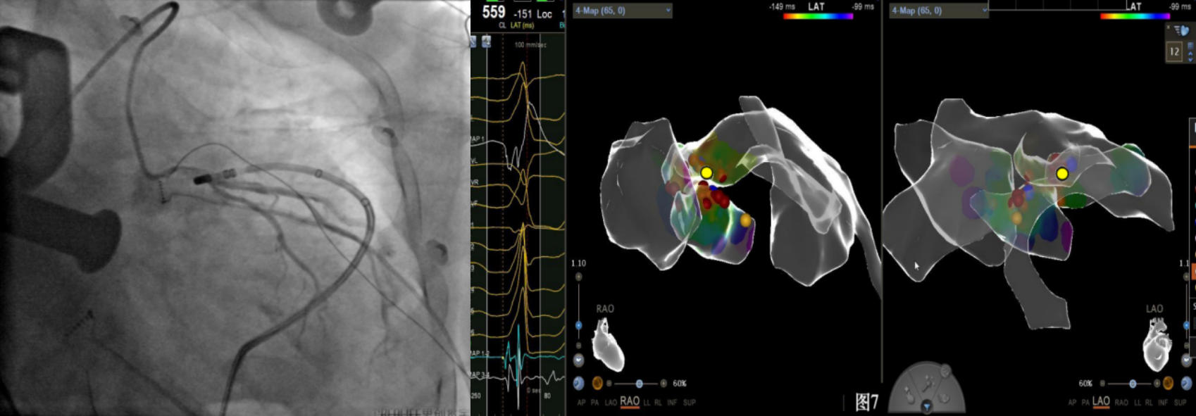 17275717148156.png 17275717148156.png