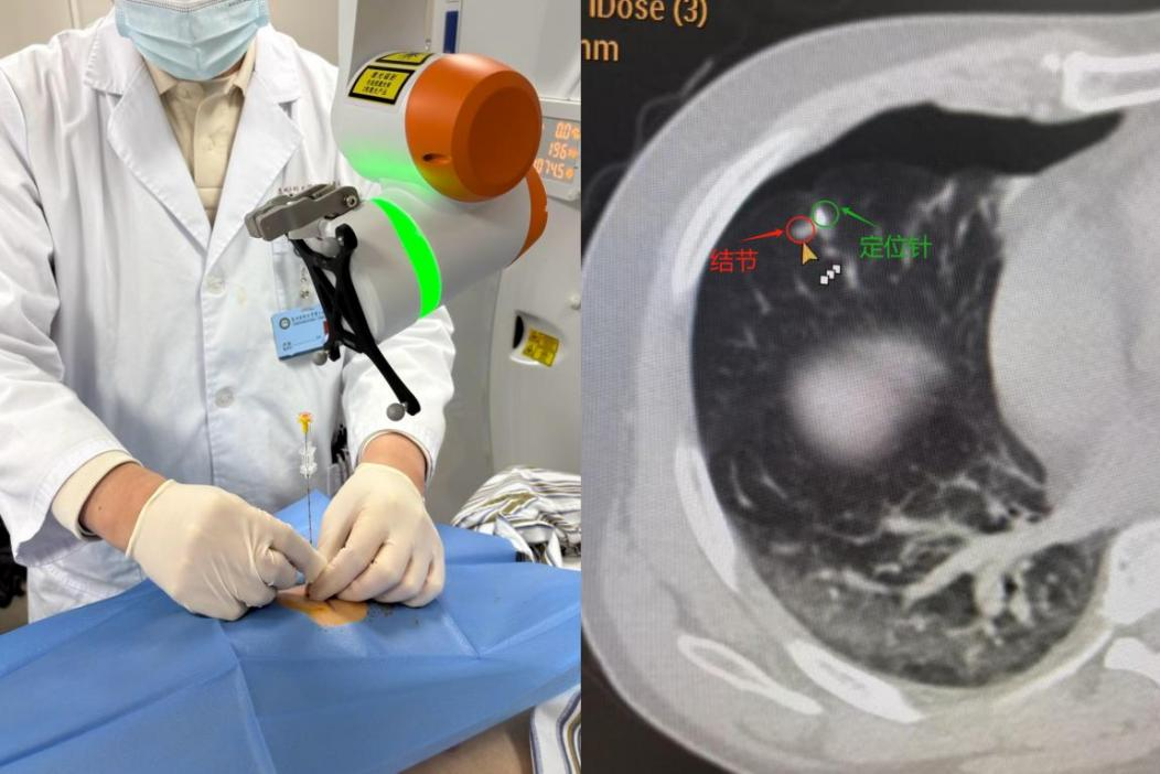 17394089318630.png 17394089318630.png