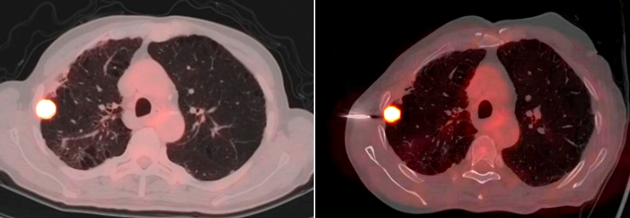 17418261992914.png 17418261992914.png