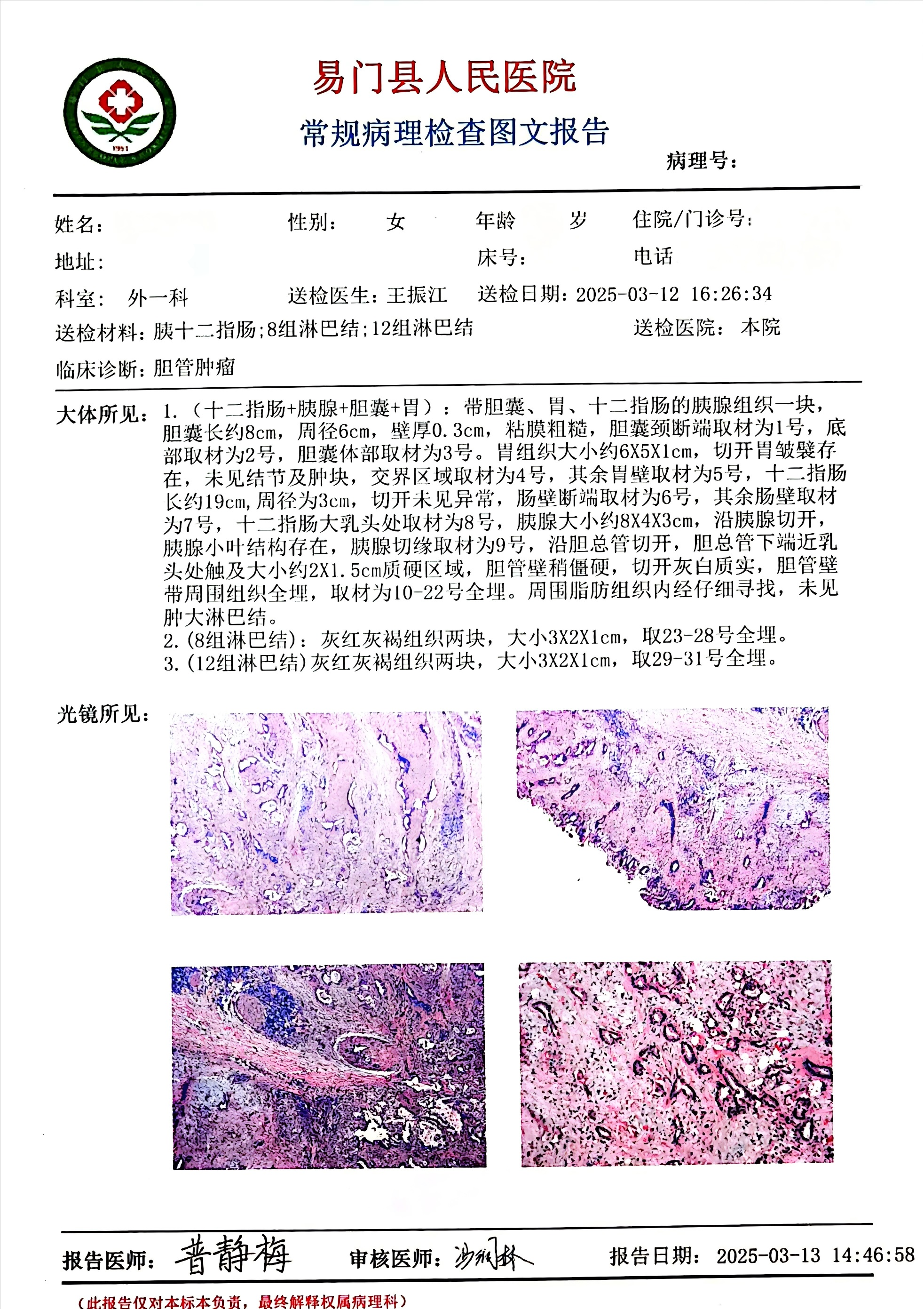 17421717299345.png 17421717299345.png