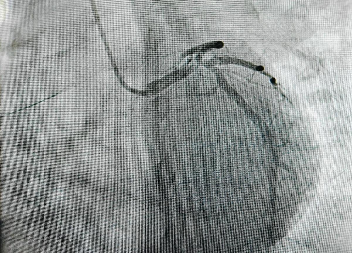 17435545323267.png 17435545323267.png