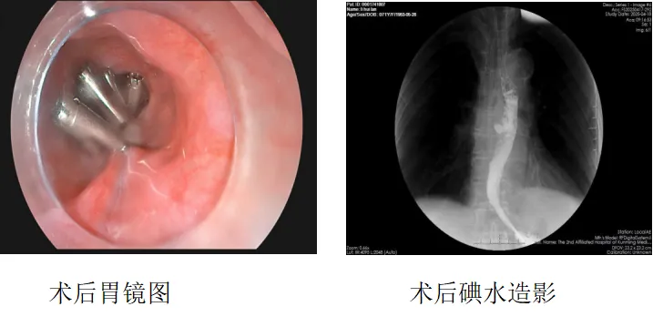 17465142386447.png 17465142386447.png